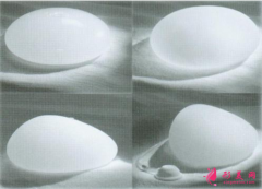 假体隆胸术后会痛多久？