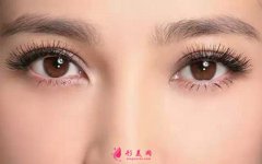 切开双眼皮术后吃什么比较好？