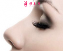 假体隆鼻后会晃动吗？