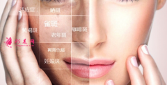 激光祛斑会影响皮肤的健康吗？