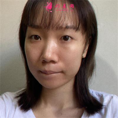 37571252b1e4-half.png