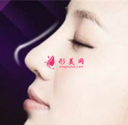 假体隆鼻哪里做得好？