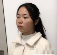 西安高一生医疗美容医院价格表，附面部吸脂案例分享