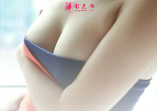 假体隆胸大概多久恢复好