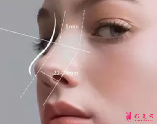 假体隆鼻恢复期要多久