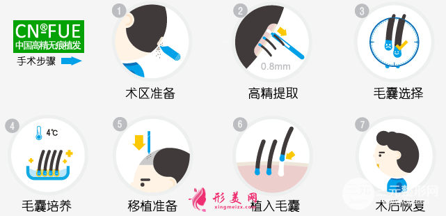 上海九院植发价格
