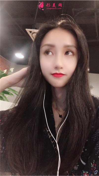 武汉发际线种植手术术后恢复效果分享 术后 武汉发际线种植手术术后恢复效果分享