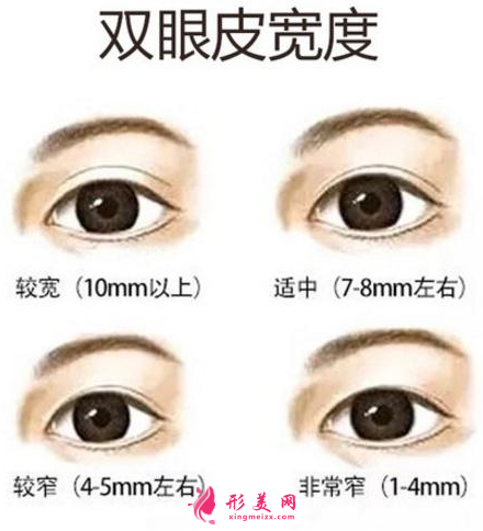 双眼皮宽度