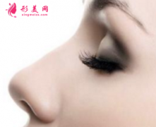 自体软骨隆鼻失败了可以取出吗？