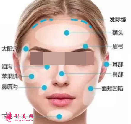 自体脂肪填充脸部有哪些风险呢