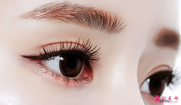 双眼皮手术方法有哪几种呢