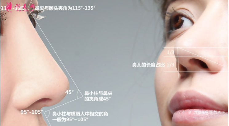 假体隆鼻以后还需要更换吗