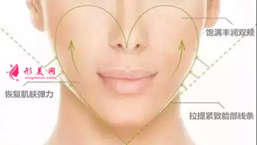 自体脂肪填充面部安全么