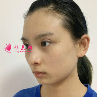 1620722540417341.png 1620722540417341.png