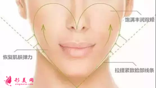 自体脂肪填充面部多久可以洗脸
