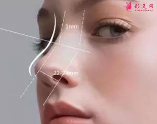 自体软骨隆鼻整形有什么优点