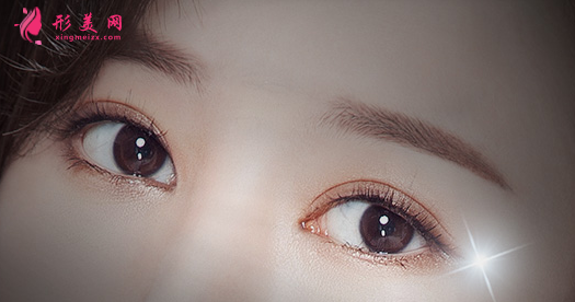 开眼角术后护理需要注意什么