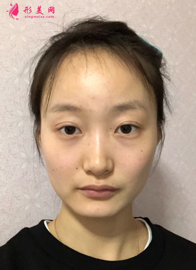 1598252522880277.png QQ截图20200824143750_resized.png