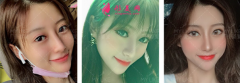鼻翼缩小整形价格收费如何？