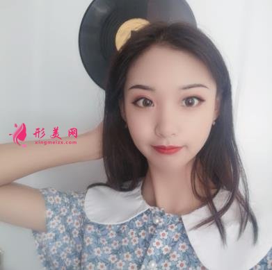 河北工程大学附属医院整形外科手臂抽脂案例分享！含吸脂价格表公开
