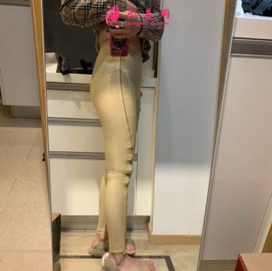 新疆医科大学第一附属医院整形科怎样?通过真实吸脂案例对比让你明白