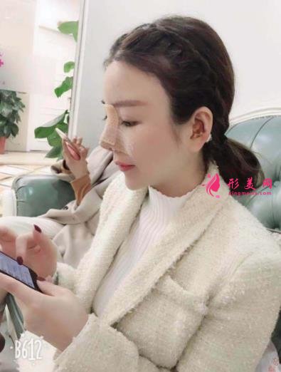 南京康美冯思阳隆鼻怎么样?看完下面真实案例及价格收费表再来评价