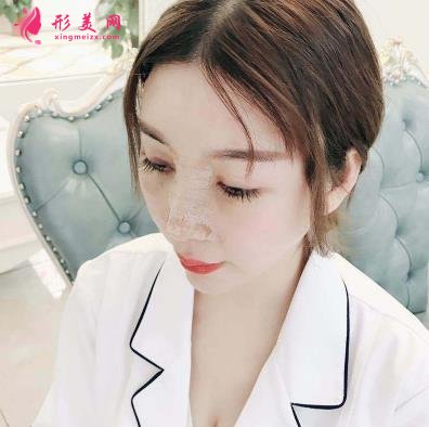 南京康美冯思阳隆鼻怎么样?看完下面真实案例及价格收费表再来评价