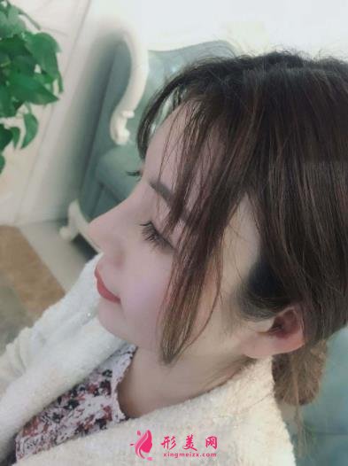 南京康美冯思阳隆鼻怎么样?看完下面真实案例及价格收费表再来评价