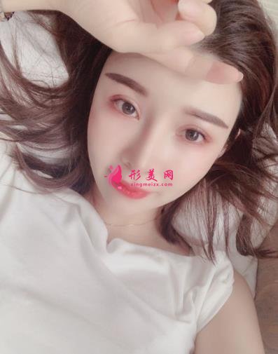 南京康美冯思阳隆鼻怎么样?看完下面真实案例及价格收费表再来评价