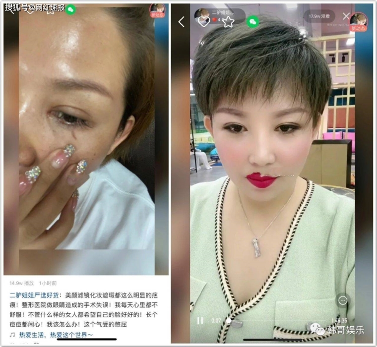 高手详解眼睛整容需要多少钱