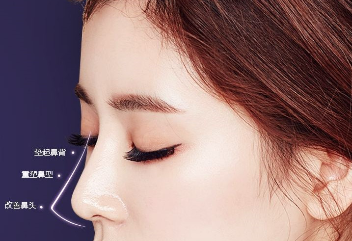 硅胶隆鼻多少钱 广州天姿医学美容医院360度全鼻整形