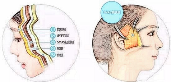 谁知道祝东升大夫5层提升费用情况?求问祝东升面部提升价格