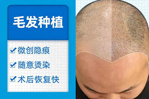 上海植发哪里好 种头发和真头发是一样的吗 上海碧莲盛头发种植贵吗