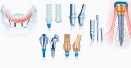 美国种植体品牌杰美zimmer怎么样?从材质和性价比方面来看!