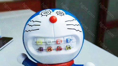 九江牙齿矫正哪家医院好?这几家技术高,案例多值得参考!