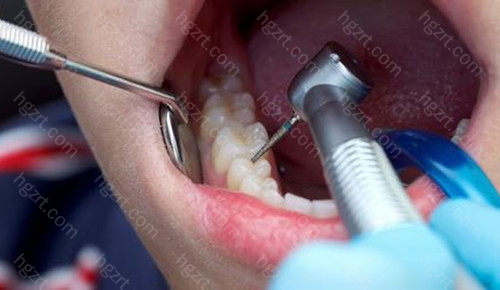 广州白云区牙科医院哪家好？这几家技术好的口腔医院不要错过