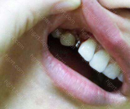 珠海种植牙医院排名及费用情况你了解吗？这份榜单请收好！