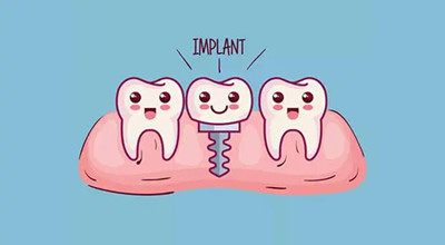 即拔即种与传统种植牙的比较，看看有什么区别