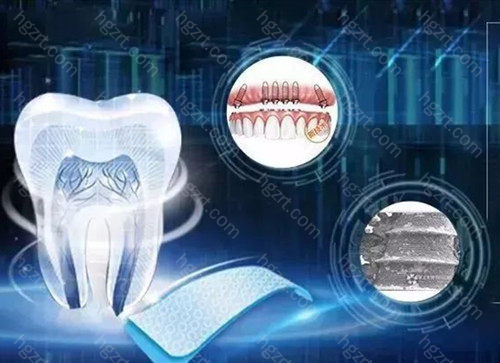 公布福州口腔医院种植牙费用，看种一颗牙到底需要多少钱