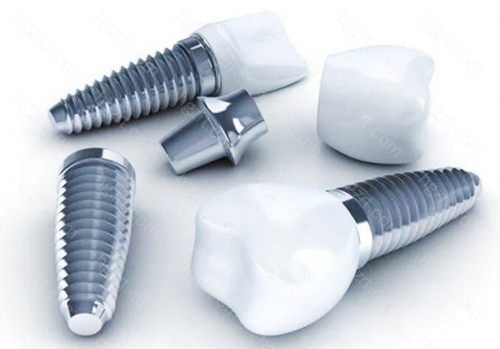 美国皓圣和德国icx哪个好？种植牙美国的好还是德国的好？