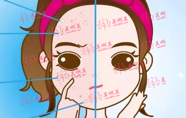 点阵激光一般怎么收费的?祛斑有效吗？会不会复发？